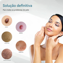 O Fim da Vergonha: Remova Sinais, Verrugas e Manchas Escuras com um Único Clique — Antes que Elas se Multipliquem.