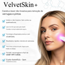 O Fim da Vergonha: Remova Sinais, Verrugas e Manchas Escuras com um Único Clique — Antes que Elas se Multipliquem.