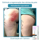 O Fim da Vergonha: Remova Sinais, Verrugas e Manchas Escuras com um Único Clique — Antes que Elas se Multipliquem.